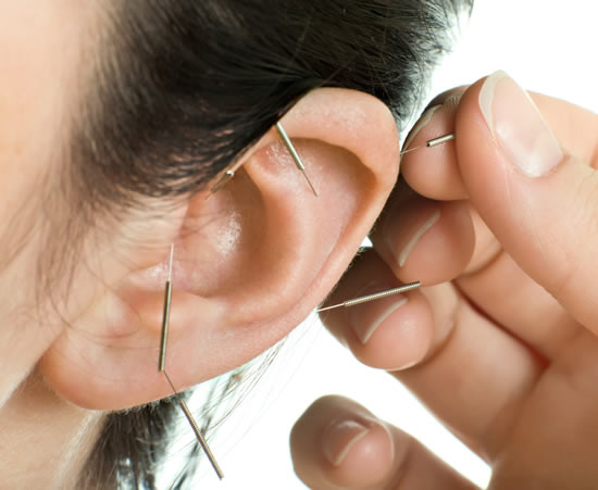 Acupuncture Gauteng
